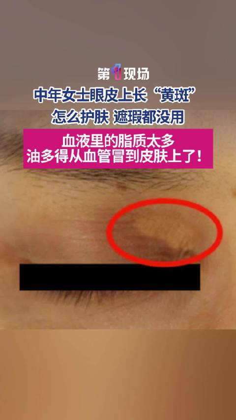 阿隆索解析平局：虽合理却遗憾，未来展望掌控比赛新篇章
